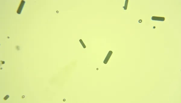 Behind the Recall: The Human Side of the Fresh and Ready Foods Listeria Outbreak Cover